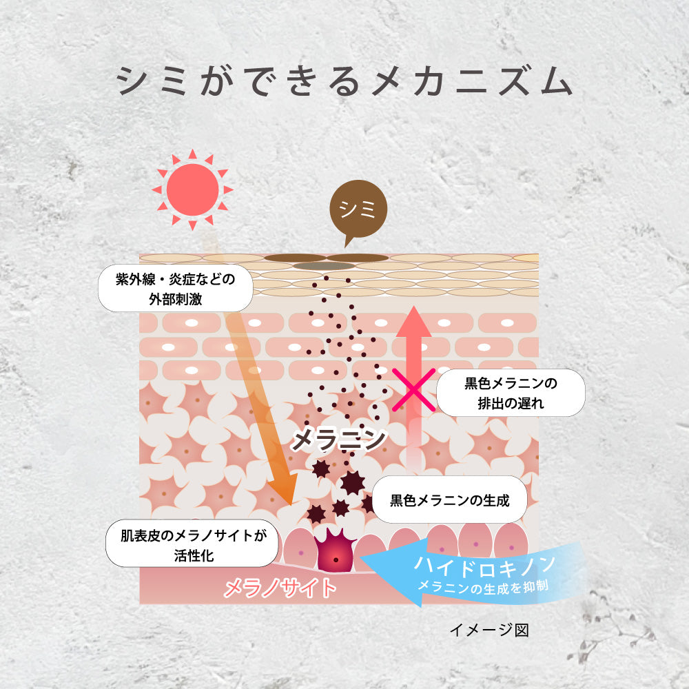 シミ ニキビ跡 色素沈着 ドクターズコスメ cellpure 皮膚科 レーザー メンズ シミ取り 12g